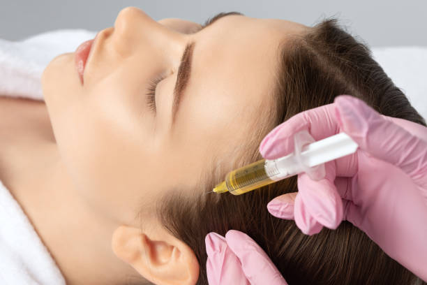 PRP Hair Treatment