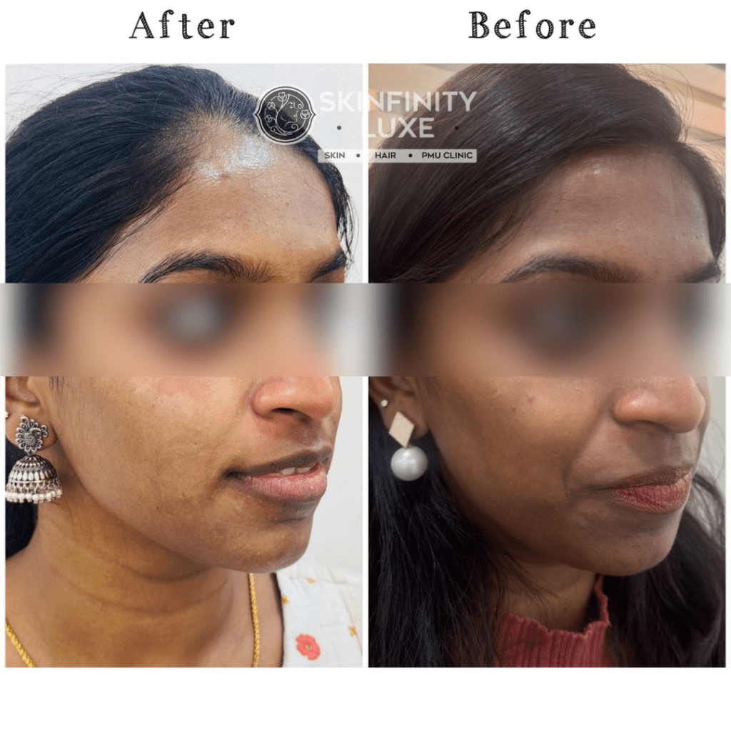 Skin Brightening Treatment