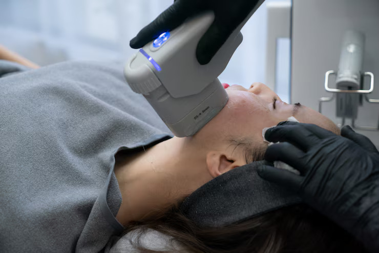 Hifu Facial Treatment