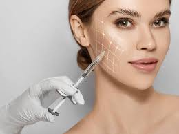 cheek dermal fillers